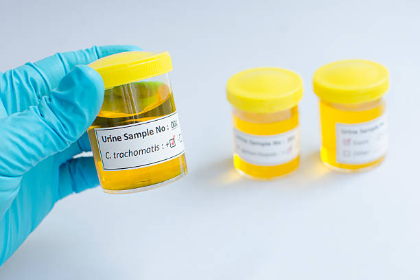 Chlamydia Test – Good Seep Diagnostics