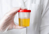 Urine Testing