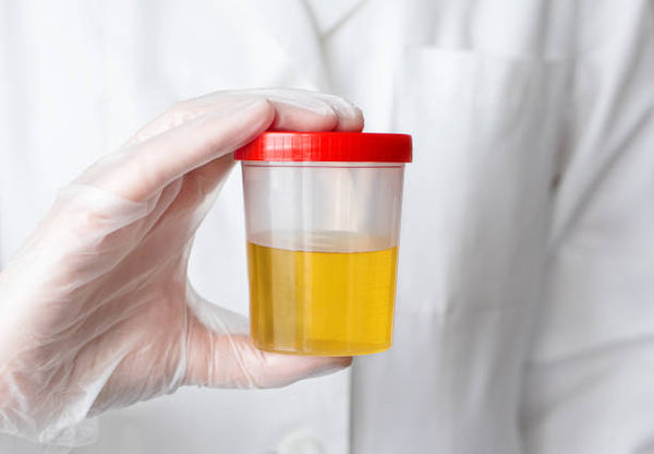 Urine Testing