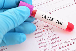CA-125 Blood Test