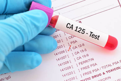 CA-125 Blood Test