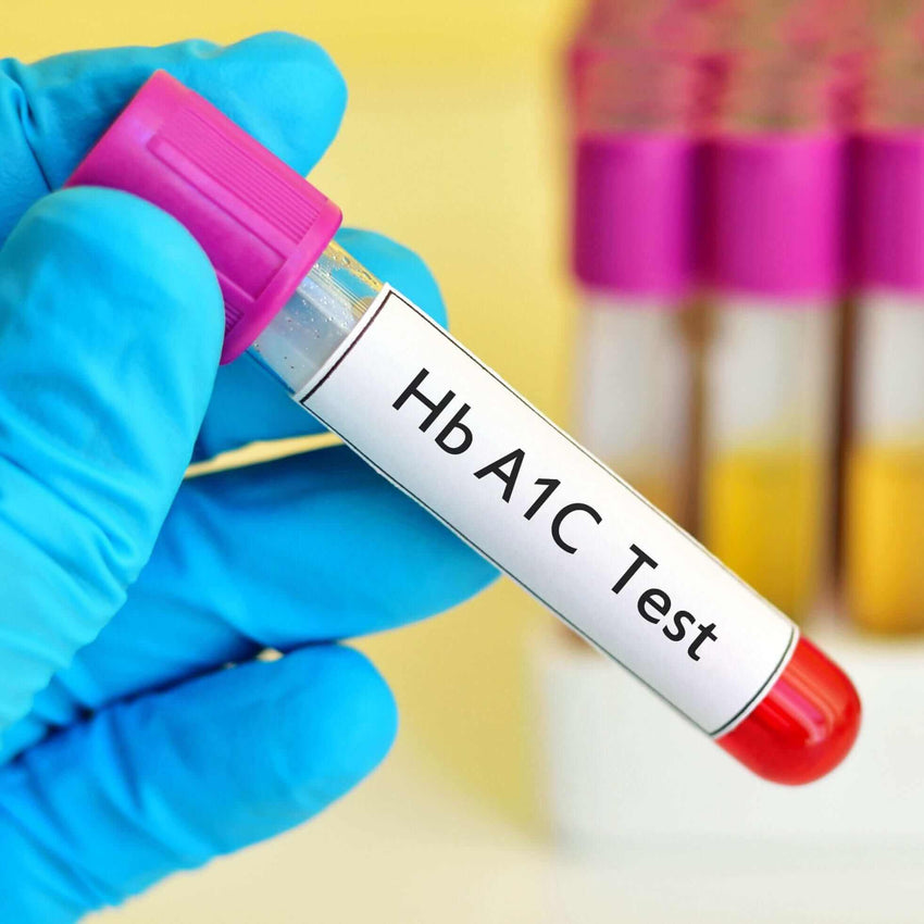 Hemoglobin A1c Test