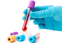 Anemia Testing