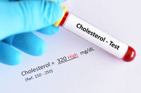 Lipid Panel -Cholesterol  Test