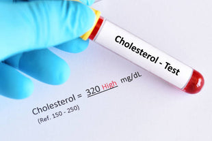 Lipid Panel -Cholesterol  Test