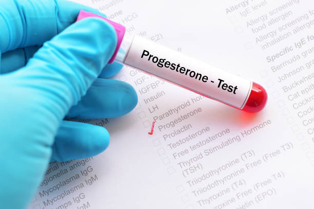 Progesterone Test