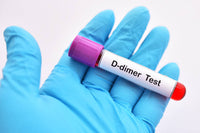 D-Dimer Test