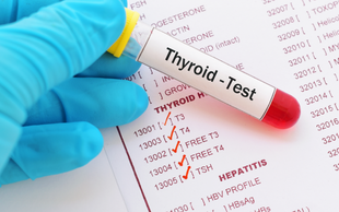 Thyroid Disorder Monitoring and Management - Ongoing