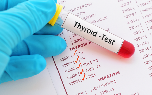 Thyroid Function Test (TSH)