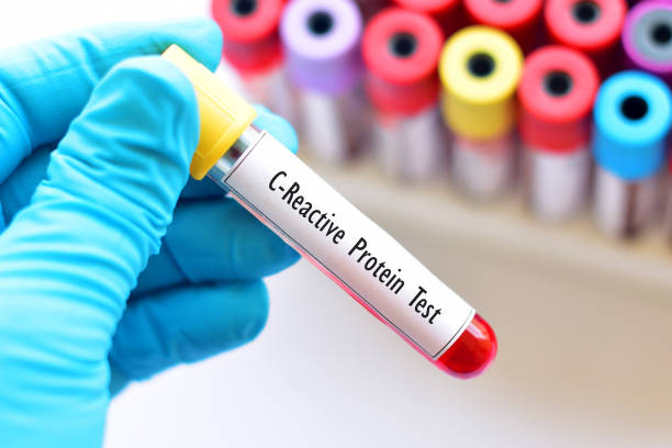 High Sensitivity C-Reactive Protein Cardiac
