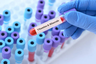 Essential Vitamin & Mineral Panel