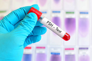 Follicle Stimulating Hormone (FSH)
