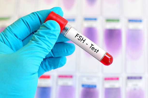 Follicle Stimulating Hormone (FSH)