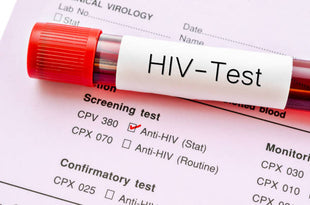 HIV Test