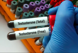 Testosterone, Free & Total