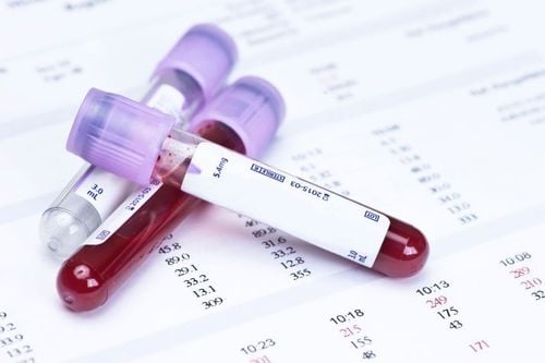 Complete Blood Count (CBC)