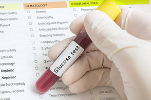 Glucose Blood  Test