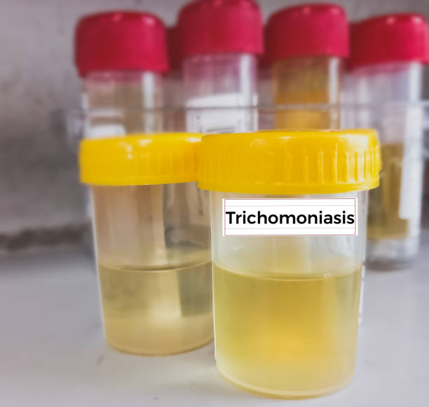 Trichomoniasis Test