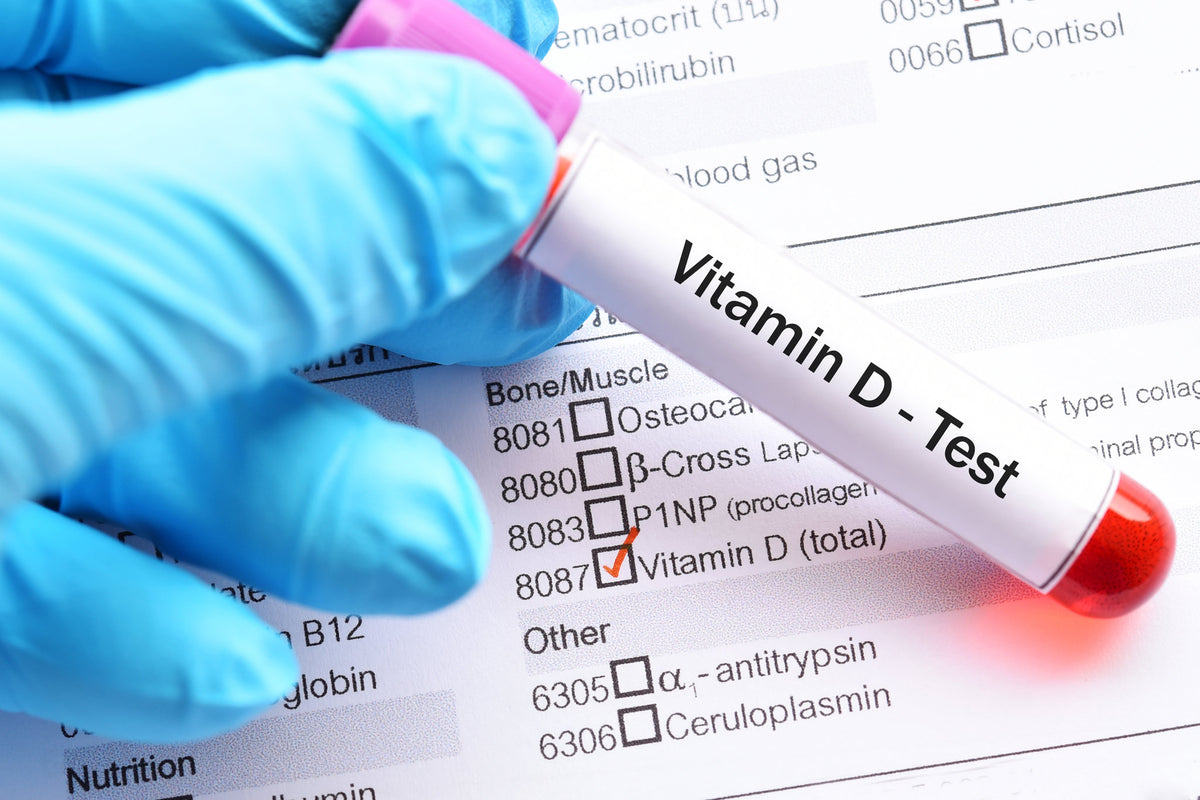 Vitamin D Test – Good Seep Diagnostics